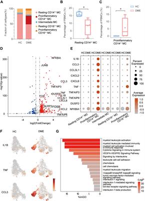 Immune Cell Landscape of Patients With Diabetic Macular Edema by Single-Cell RNA Analysis